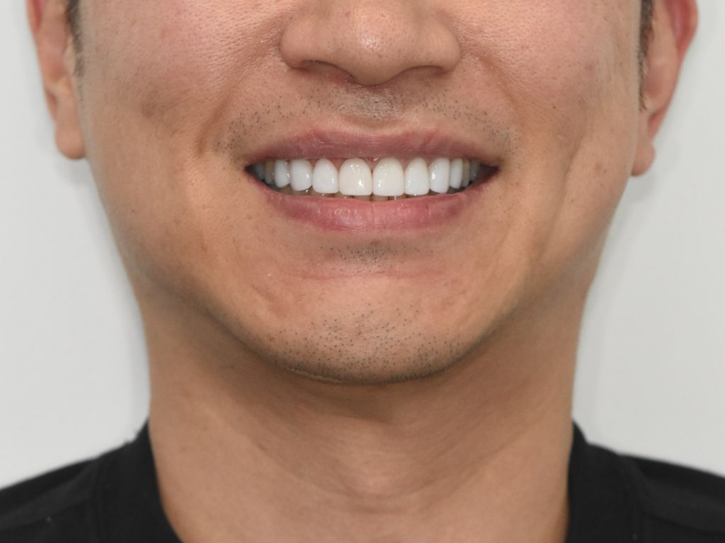 Case 01 — after treatment