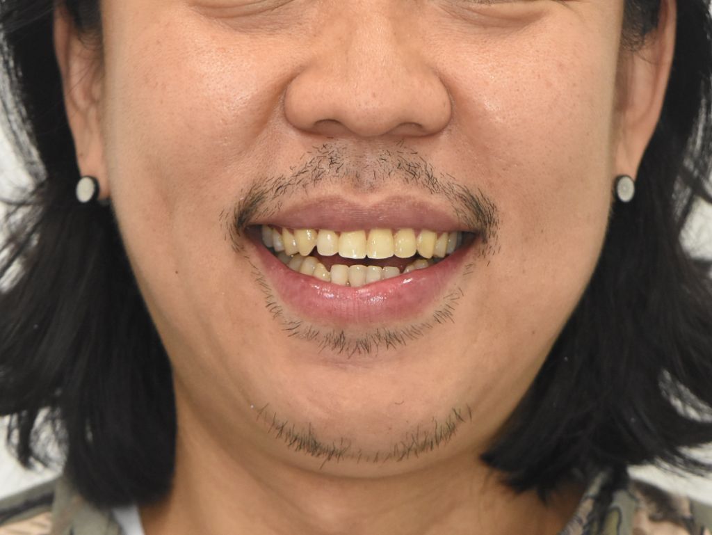 Case 02 — before treatment